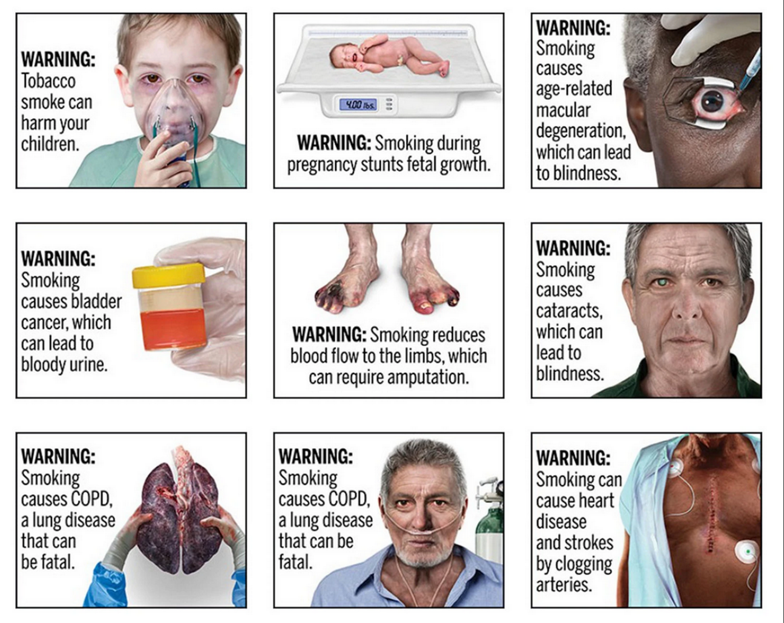 Disturbing – But Realistic – Images for Cigarette Packaging